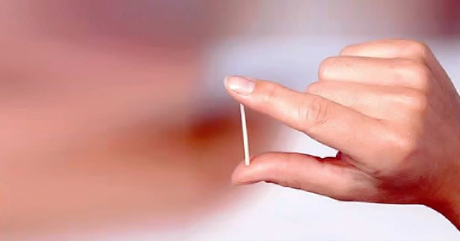 implante anticoceptivo